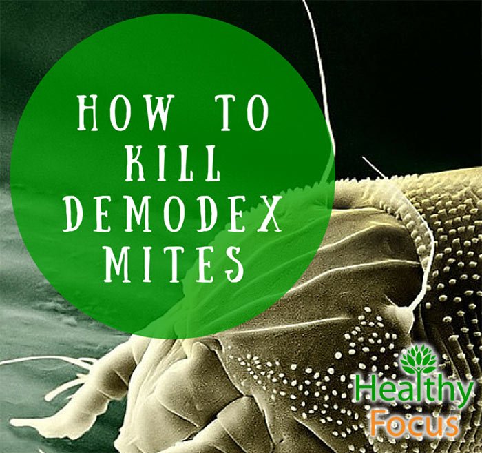 Demodex | DermNet New Zealand