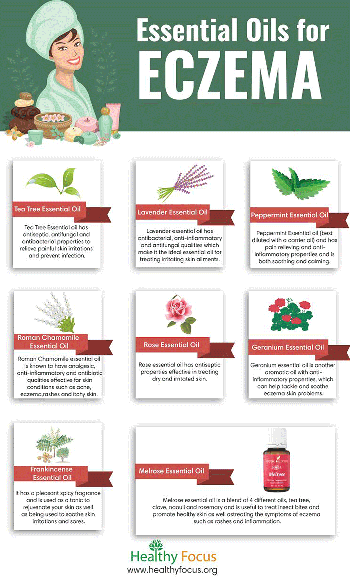 essential oils for eczema infographic