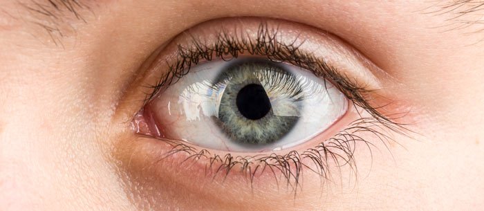 manuka honey for Corneal Oedema