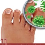 11 Science Backed Essential Oils for Toenail Fungus