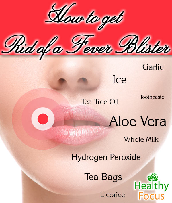 how-to-get-rid-of-a-fever-blister-healthy-focus