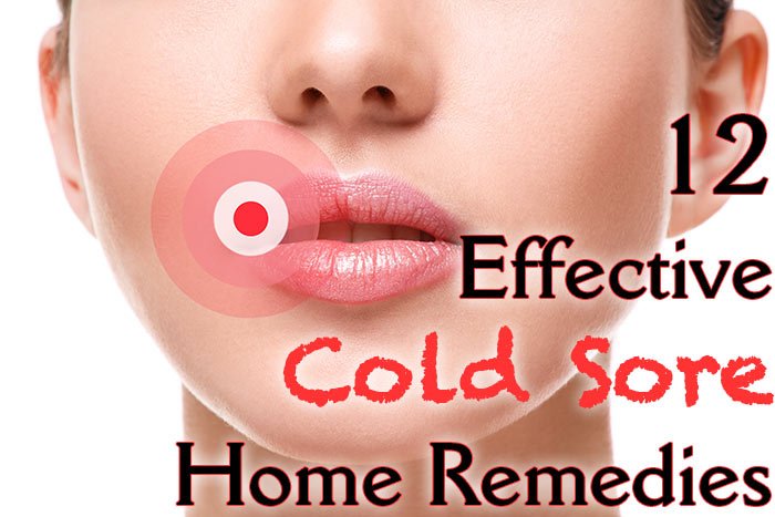 12 Effective Cold Sore Home Remedies Healthy Focus