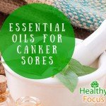 Essential Oils for Canker Sores