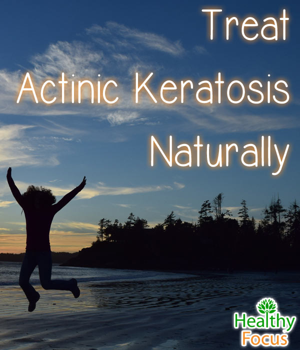 9 Tested Actinic Keratosis Natural Treatments Healthy Focus