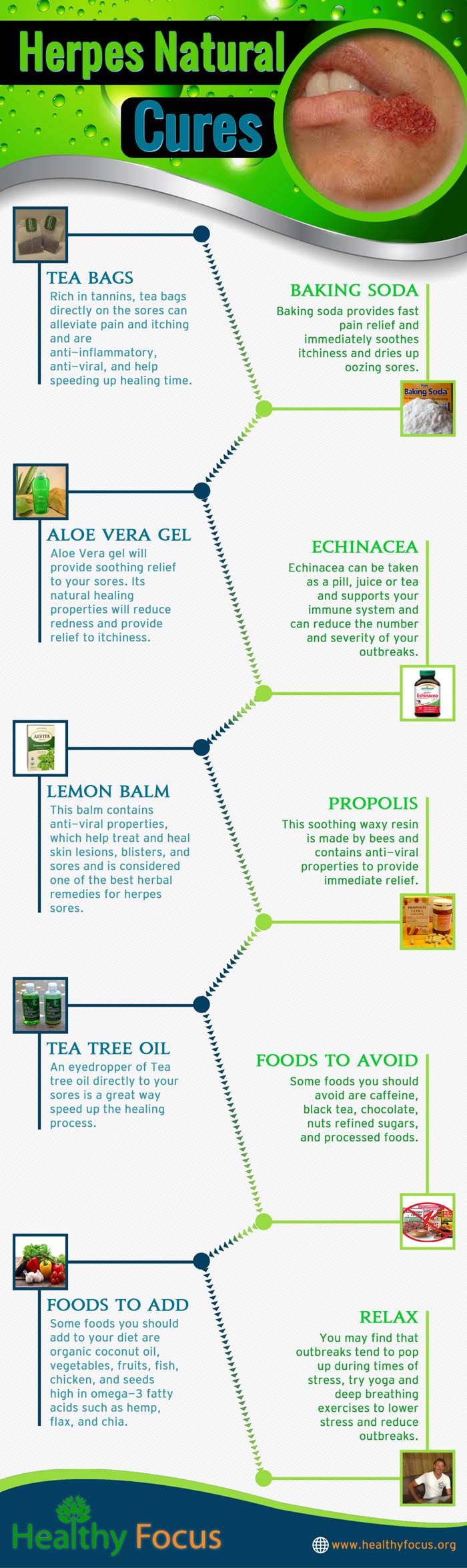 Herpes Natural Cures ig