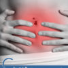 Clostridium Difficile Diet