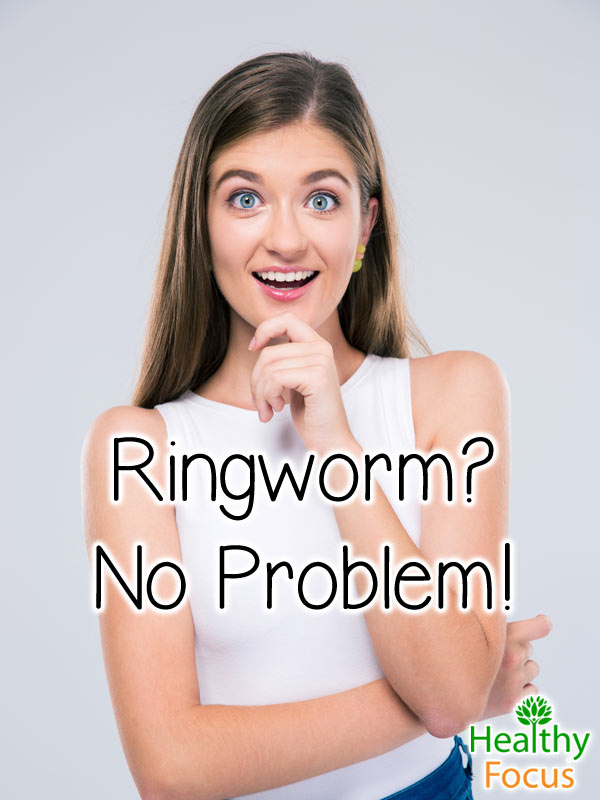 mig-ringworm