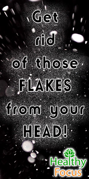 mig-Get-rid-of-those-FLAKES-from-your-HEAD