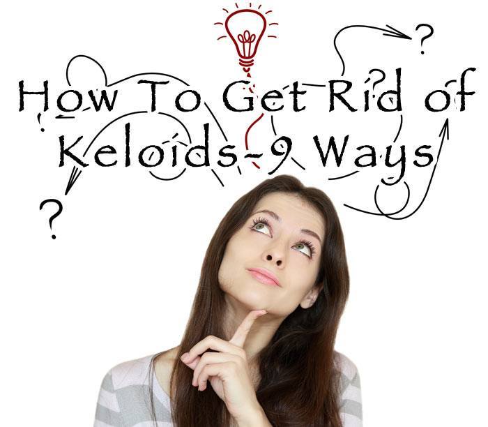 hdr-How-To-Get-Rid-of-Keloids-9-Ways