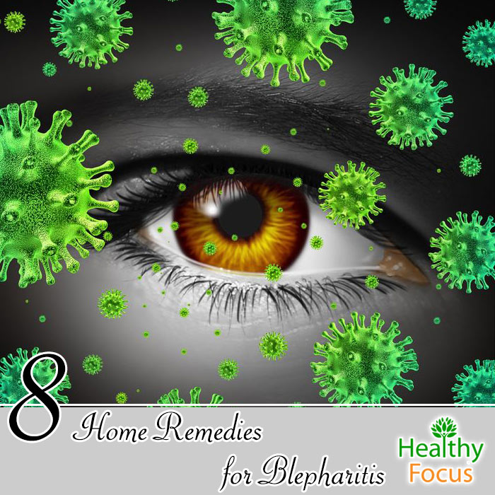 8 Home Remedies For Blepharitis Healthy Focus