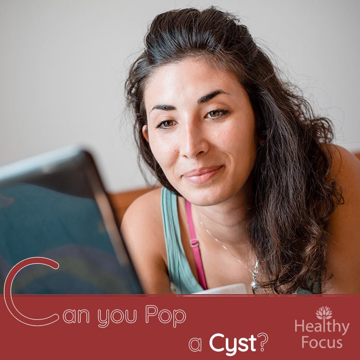 can-you-pop-a-cyst-healthy-focus