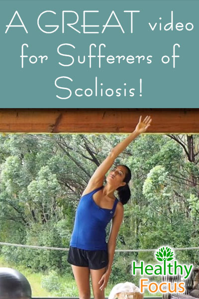 Effective Exercises for Scoliosis 2 mig-a-great-video-for-sufferers-of-scoliosis