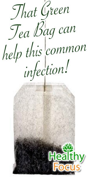 How to Get Rid of a Stye 5 mig2 That Green Tea Bag can help this common infection