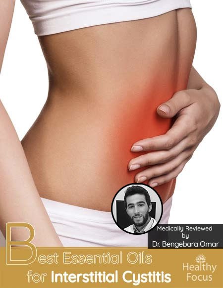 Best Essential Oils for Interstitial Cystitis-New Tips 1 Best Essential Oils for Interstitial Cystitis
