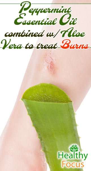 8 Proven Essential Oils For Burns 2 mig Peppermint essential oil combined w Aloe Vera to treat burns