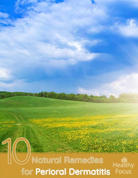 10 Natural Remedies for Perioral Dermatitis 1 10 Natural Remedies for Perioral Dermatitis