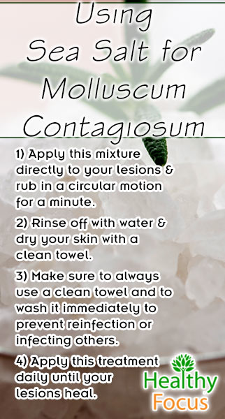 Molluscum Contagiosum Home Remedies 3 mig Using Sea Salt for Molluscum Contagiosum