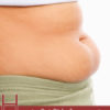 How to Get Rid of Lower Belly Fat