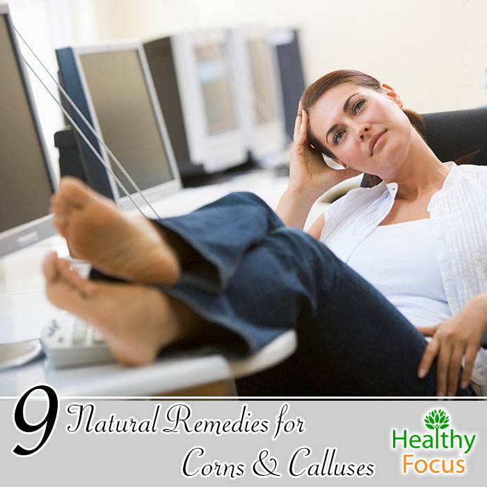 9 Natural Remedies for Corns and Calluses 1 hdr-9-natural-remedies-for-corns-and-calluses