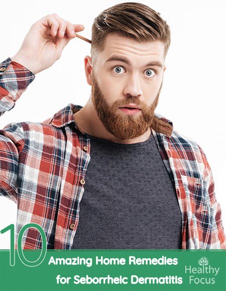 10 Amazing Home Remedies for Seborrheic Dermatitis 1 10 Amazing Home Remedies for Seborrheic Dermatitis