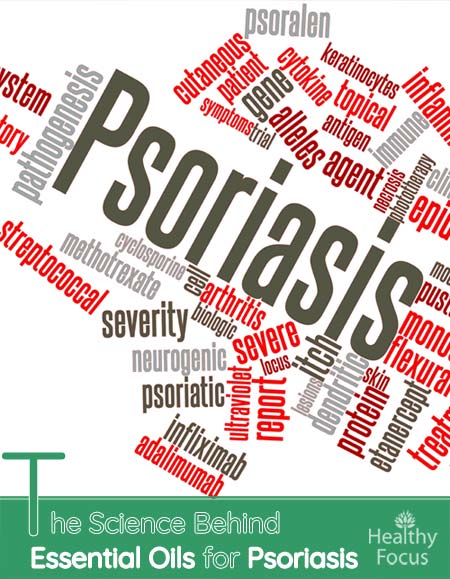 The Science Behind Essential Oils for Psoriasis 1 hdrs The Science Behind Essential Oils for Psoriasis