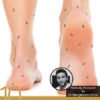 10 Science Backed Vitamins and Supplements for Neuropathy