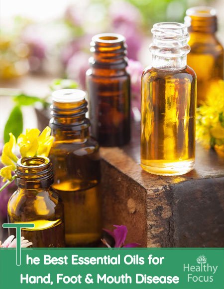 The Best Essential Oils for Hand, Foot and Mouth Disease 1 The Best Essential Oils for Hand, Foot & Mouth Disease